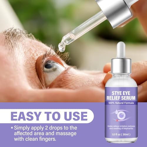 Stye Eye Treatment, Eye Reflief Serum for Styes and Chalazions, Natural & Non-Irritating, Fast-Acting Soothing and Restores Healthier Skin, 30ml