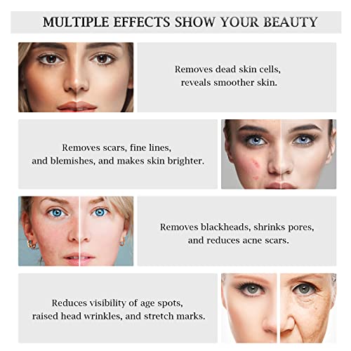 3 in 1 Diamond Microdermabrasion Machine, Professional Microdermabrasion Device with Vacuum Spray, Beauty Facial Skin Care Dermabrasion Equipment for Salon Personal Home Use