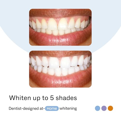 Opalescence GO Home Advanced Teeth Whitening Trays 15% (10 Treatments) Hydrogen Peroxide PF Whitening Prefilled Kit - Developed by Leaders in Professional Whitening 5822-T