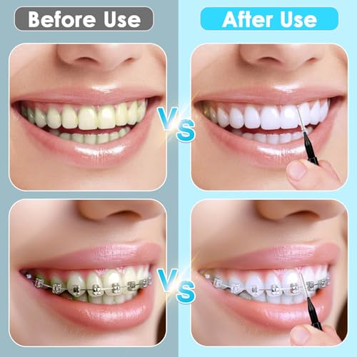 270Pcs Interdental Brush, 220Pcs Soft Dental Picks & 50Pcs Braces Brush for Teeth, Bendable Braces Flossers Heads Interdental Brushes Between Teeth Oral Tooth Braces Cleaner Kit (Black)