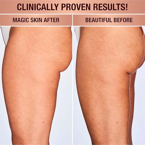 Charlotte Tilbury Magic Body Cream - Skin Tightening Cream for Body Enriched with Caffeine, Hyaluronic Acid & Shea Butter - Nourishes, Smooths & Hydrates Skin