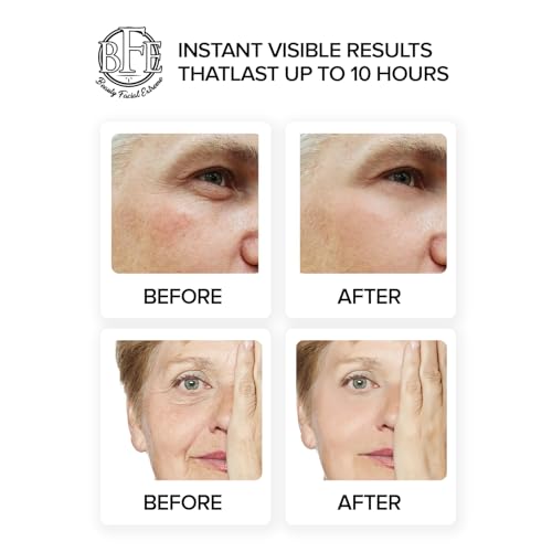 Instant Eye Tightener Cream - Reduces Under Eye Puffiness, Bags, Dark Circles. Lift Technology to Tighten & Firm Sagging Skin Around Eyes. Smooths Away Crow’s Feet, Fine Lines & Wrinkles.