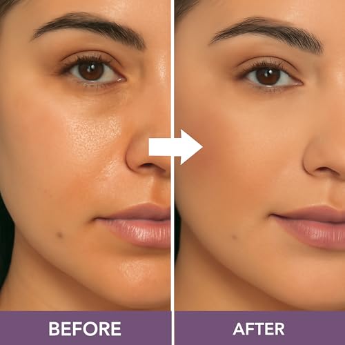 Dermaflage Mineral Powder Sunscreen for Sensitive Skin - Full Coverage, Conceals Acne Scars & Discoloration, Made in the Shade, 7g/0.25 oz - Dark