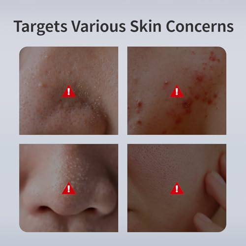 MATERN'ELLA Mud Mask | Pore Purifying Oil-Control Manicouagan Clay Formula with Plant Extract for Blackheads, Oily & Dull Skin Clay Facial Treatment for Women & Men 7.1 Oz.