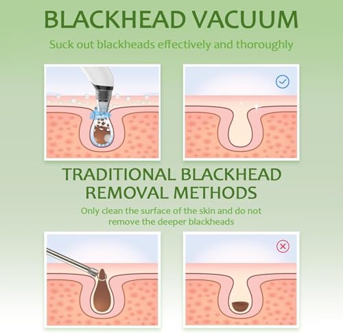 Blackhead Remover Pore Vacuum - Facial Pore Cleaner with 3 Adjustable Suction Levels, 4 Blackhead Removal Tools, Electric Acne Extractor Tool for Women & Men