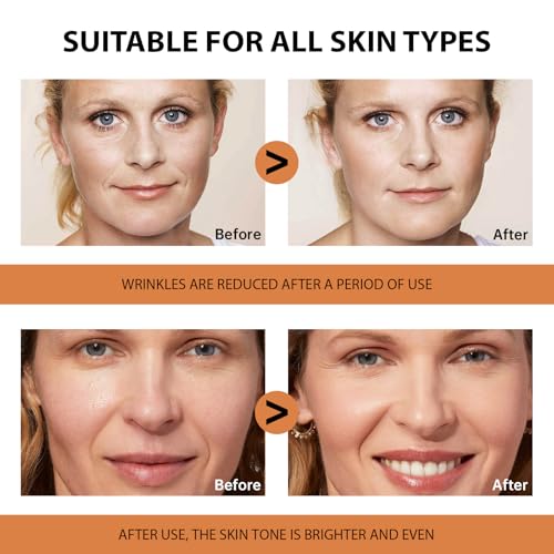 VGO Vitamin C Serum for Face, Vit C Anti Aging Serum with Hyaluronic Acid & Vitamina E, Deep Hydration Facial Care for All Skin Types, 1.01oz / 30ml