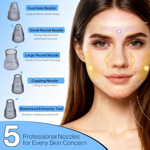 Heated Pore Vacuum, Blackhead Remover with Strong 3-Level Suction, 5 Nozzles for Deep Cleaning Face, Nose & Sensitive Skin, Professional Pore Extractor & Facial Kit