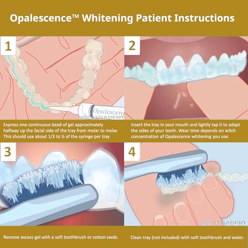 Opalescence 45% Syringes Teeth Whitening Gel - with PF - (4 Syringes) Refill Kit Carbamide Peroxide. Made by Ultradent, in Mint Flavor. Tooth Whitening 5359-2