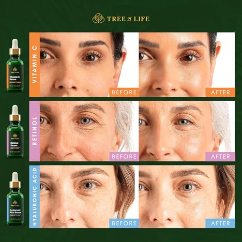 Tree of Life Beauty Facial Skin Care Set, Firming, Hydrating, Dry Face, Dermatologist Tested - Trio Power Kit, Vitamin C, Retinol and Hyaluronic Acid, 3 count of 1 Fl Oz