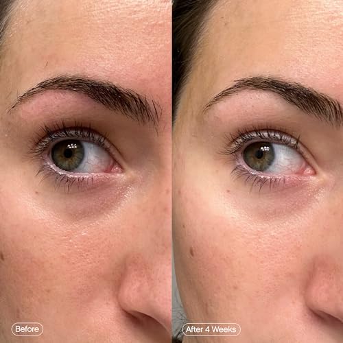 Topicals Faded Brightening Under Eye Masks | Revitalizing Patches to Depuff, Hydrate, and Illuminate | Diminishes Dark Circles and Fine Lines | Made with Kojic Acid, Caffeine & Niacinamide