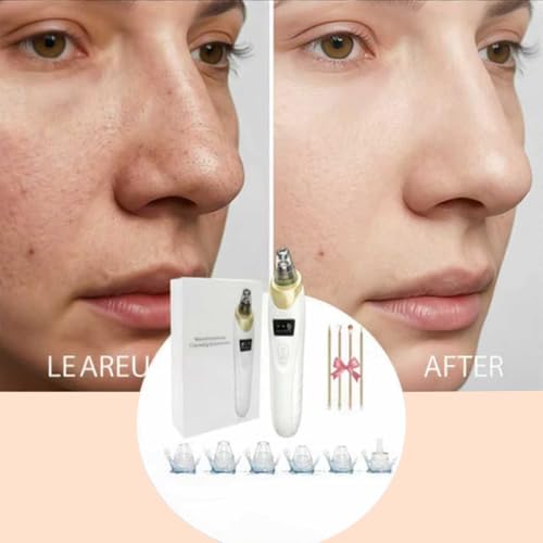 2026 Blackhead Remover with 5 Suction Heads & 4 Gold Extractor Needles, Electric Blackhead Vacuum Pore Vacuum for Deep Facial Cleaning, USB Rechargeable for Women & Men-Khaki