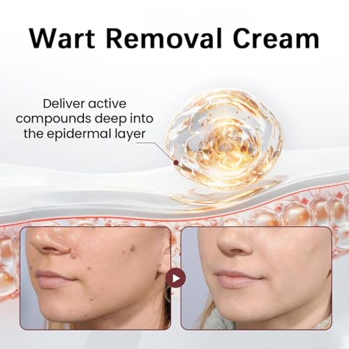 KeraErase Dual-Action Renewal Cream, Black and White Rice Soothing Repair cream, Natural Body Serum Suitable for All Skin Types. 2pcs