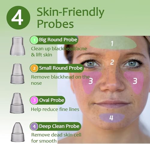 Blackhead Remover Pore Vacuum - Facial Pore Cleaner with 3 Adjustable Suction Levels, 4 Blackhead Removal Tools, Electric Acne Extractor Tool for Women & Men