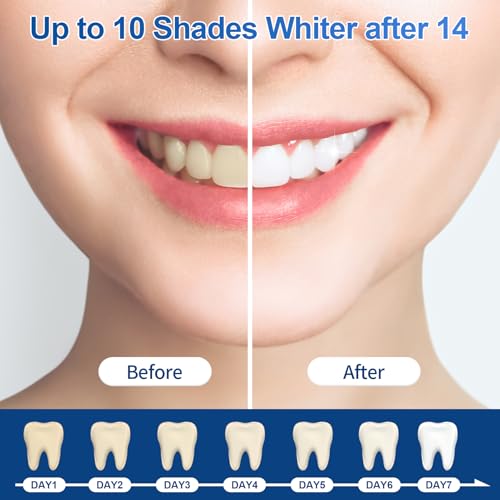 35% Ganencsnc 10-Pack Teeth Whitening Gel Refills - Gentle 35% Carbamide Peroxide Formula - Compatible with Teeth whitening Kit,No Sensitive Teeth Whitener