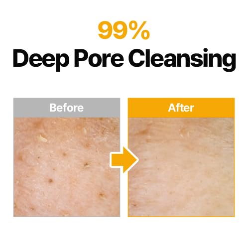 MANYO Pure Cleansing Oil, Natural Oil Cleanser for Face, Makeup Blackhead Remover, Korean Skin Care, 6.76 fl oz (200ml)