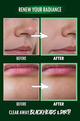 [K-Beauty] Neogen Dermalogy Pore Zero Peeling Mousse | All-in-One Foaming Exfoliating Face Wash Visibly Firming, Tightening & Lifting Skin 3.38 fl oz