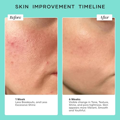 DERMAdoctor Pore Minimizer Niacinamide Serum for Face | Vitamin B3 Niacinamide Oil Control Pore Minimizer for Visible pores, Blackheads, Uneven Skin Tone, Redness, Oily Skin - Dermatologist Formulated