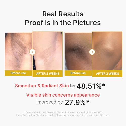 medicube Body Peel Shot with Turmeric | Gentle Body Exfoliating Serum with BHA, LHA & PHA for Dead Skin Cells, Uneven Looking Skin & Excess Sebum | 9.46 fl.oz