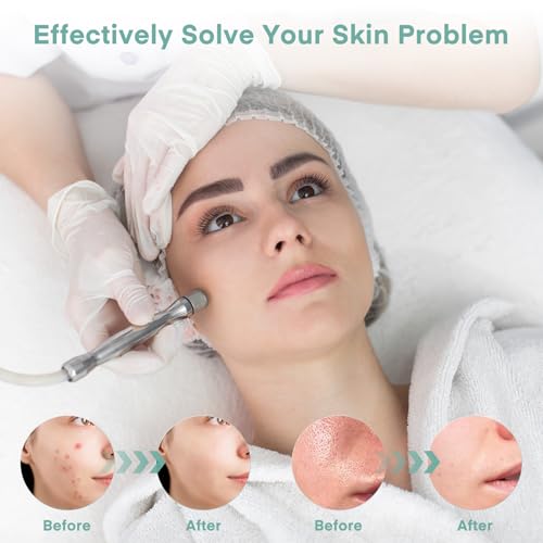 Professional Diamond Micro-dermabrasion Machine, Yofuly Diamond Micro-dermabrasion Dermabrasion Equipment Facial Peeling Spa(0-68cmHg)