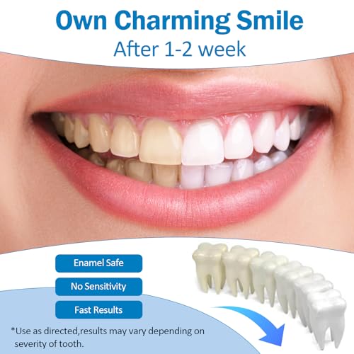 Teeth Whitening Pen - Professionally Stain Removal Teeth Whitening Gel Formula, No Sensitivity Effective Teeth Whitener, Mint (0.11 Fl Oz (Pack of 4))