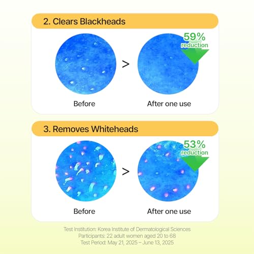 Green Tangerine Pore Tok-Tok Sheet Mask (3-in-1 Bio-Cellulose Gel) (Eosidin Care) – Pore Care, Sebum Control, Collagen Peel Off Facial Skincare for Deep Cleansing & Smooth Skin, 4 Sheets