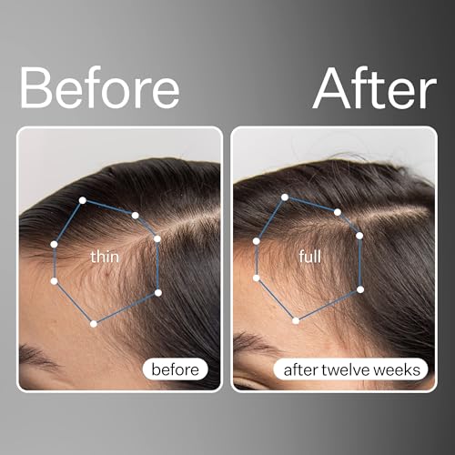 Act+Acre Cold Processed Stem Cell Scalp Serum - Promotes Thicker and Fuller-Looking Hair - Soothes and Hydrates the Scalp - Sulphate and Paraben Free - Aloe Vera for Improved Scalp Health - 1 fl oz.