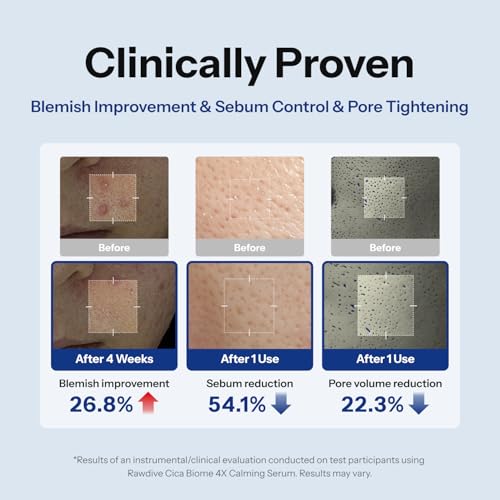 Cica Biome 4X Calming Serum, Centella Asiatica & Niacinamide Facial Serum for Sensitive Skin, Soothing & Pore Care, Korean Skincare (1.01 Fl Oz / 30ml)