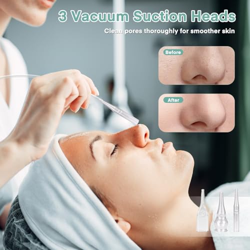 Professional Diamond Micro-dermabrasion Machine, Yofuly Diamond Micro-dermabrasion Dermabrasion Equipment Facial Peeling Spa(0-68cmHg)