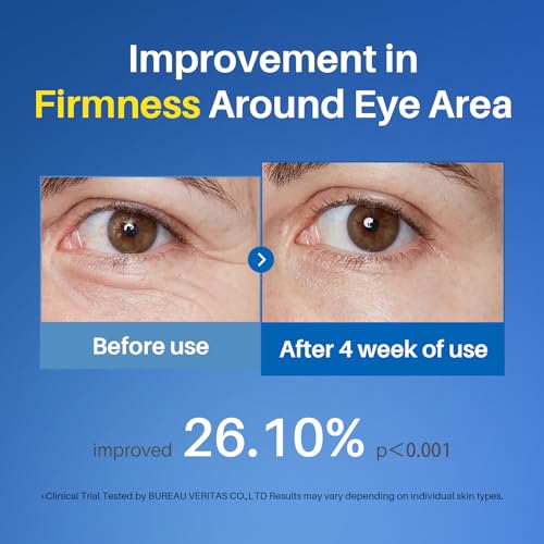 SPODARE Caffeine Eye Cream, Under Eye Cream for Dark Circles, Puffiness & Puffy Bags, Wrinkles Fine Lines, Eye Roller Serum with 360° Massage Ball for Women and Men - 0.7 fl. oz