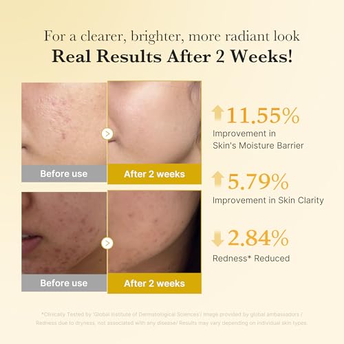 medicube Kojic Acid Turmeric Clarifying & Balancing Capsule Serum for Troubled Skin | Soothing & Brightening Facial Serum | Niacinamide & Glow Capsules for Hydration and Barrier Support | 1.01 fl.oz