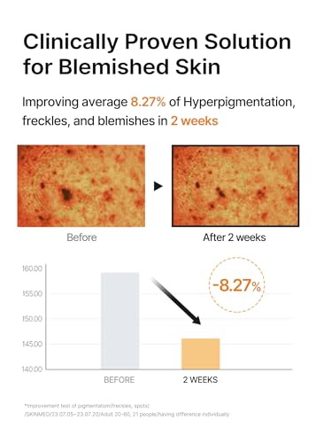 celimax Pore+Dark Spot Brightening Pad | Exfoliating Peeling Pads for Enlarged Pores, with Hyaluronic Acid, Pore Minimizer, Non-Irritating, Hydrating, For Sensitive Skin (40 pads)