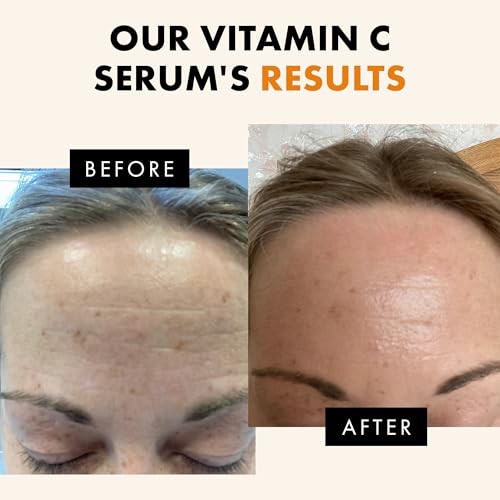 Eclat Skincare Vitamin C Serum - Skin Care for Dark Spots, Vitamin C Serum for Face with Hyaluronic Acid, Ferulic Acid, & Vit E - Anti Aging and Skin Brightening Vit C Formula for Face Care 1 Fl Oz