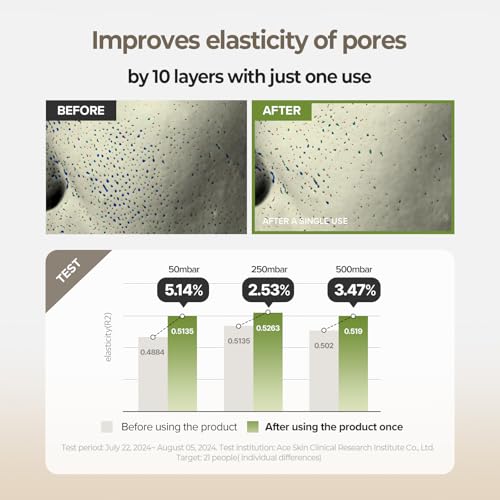 SKINFOOD Rice Serum, 48 Hours Fermented Rice Water Skincare Korean Serum for Face, Korean Rice Skincare for Natural Glow Glass Skin, Pore Minimizer, Rice Water Bright, 55ml/1.86fl.oz.