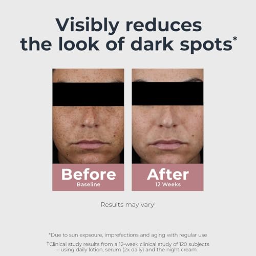 Eucerin Radiant Tone Dual Serum Dark Spot Corrector, Dark Spot Serum with Thiamidol and Hyaluronic Acid, Helps Visibly Reduce the Look of Persistent Dark Spots, 1 Fl Oz Bottle