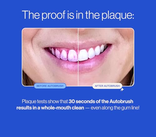 Autobrush Sonic Pro Electric Toothbrush – Only ADA Accepted U-Shaped Brush, Clinically Proven Up to 5.1X Better Cleaning, 30-Second Full Mouth 360 Clean, Rechargeable, Waterproof, Black, Men's Regular