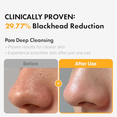 Hanskin Pore Cleansing Oil, Oil Cleanser for Face, Makeup Blackhead Sebum Remover, Korean Deep Pore Cleanser for Sensitive Skin [PHA] (10.14 oz)