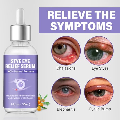 Stye Eye Treatment, Eye Reflief Serum for Styes and Chalazions, Natural & Non-Irritating, Fast-Acting Soothing and Restores Healthier Skin, 30ml