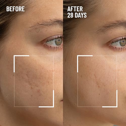 Dr. Brandt Microdermabrasion Renewing Face Exfoliator - Reduces Dull Skin, Uneven Texture, Fine Lines, Acne Scars & Wrinkles - 2.0 oz