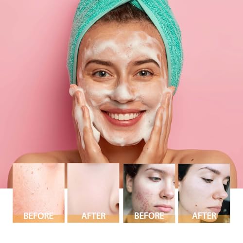 HOYGI Turmeric Face Wash with Brush, Turmeric Foaming Facial Cleanser for All Skin, 3.38 Fl Oz/pcs