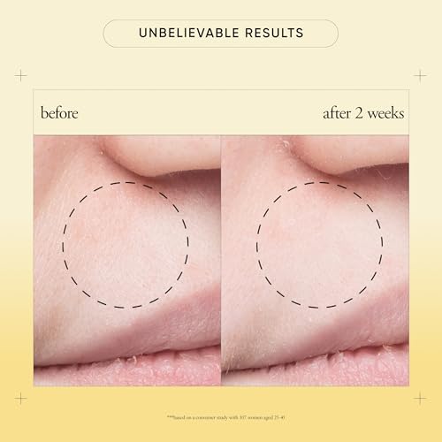 philosophy purity made simple pore extractor clay face mask - with purifying white kaolin clay, salicylic acid & natural exfoliants – removes impurities and reduces the appearance of pores