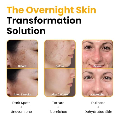 Peel Off Mask,Collagen Face Mask, Hydrating Overnight Hydrogel Mask,Gentle Skin Care, Pore Minimizing - Korean Skincare -Elasticity Improvement - Better Than Sheet Masks