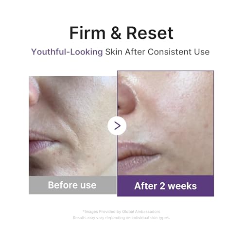 medicube Retinol Boosting Serum | Intensive Firming, Hydration & Plumping Care with Retinol, Peptides & Vitamins | Pore-Refining, Smooth Radiant Skin | Korean Skincare, 1.01 fl. oz