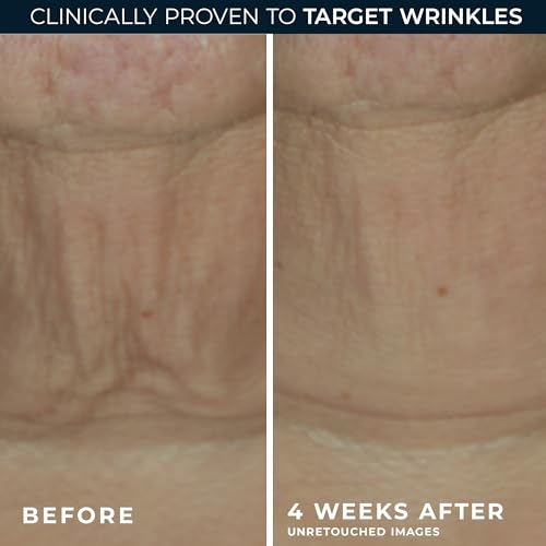 RoC Derm Correxion Retinol Firming Serum Stick with Antioxidants to Visibly Tighten and Firm Wrinkles and Laugh Lines 1.0 oz plus Retinol Eye Cream Packette