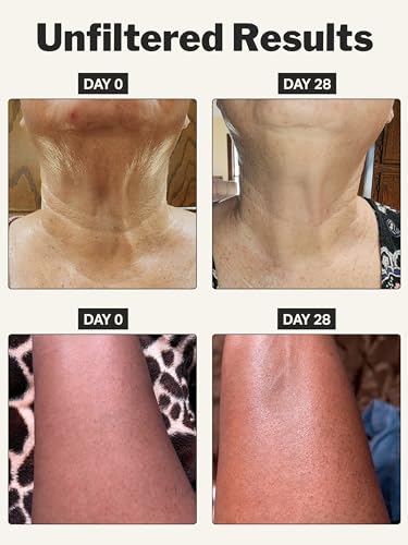 Cocokind Retinol Body Cream, Youthful Body Skin Treatment, All Skin Types including Sensitive Skin, Fragrance Free, Cruelty Free, Vegan, 8 fl oz