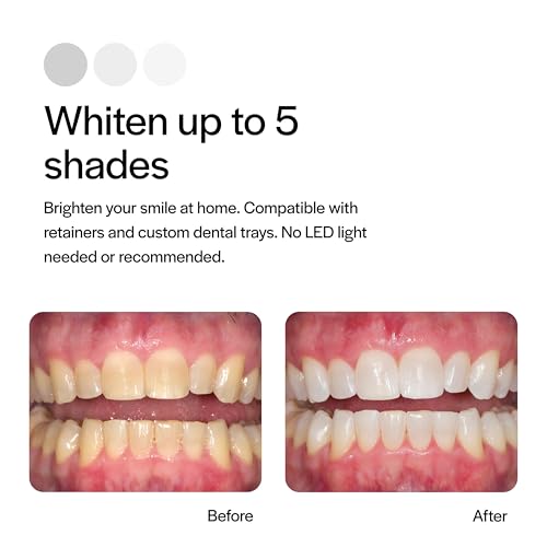 Opalescence 15% Gel Syringes Teeth Whitening Refill Kit - Low Sensivity (4 Syringes) - Cool Mint - Carbamide Peroxide - Made in The USA by Ultradent Tooth Whitening 5195-2