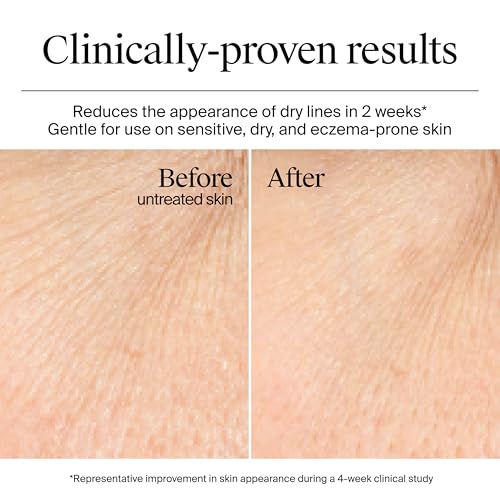 Neutrogena Hydro Boost Gel Cream with Hyaluronic Acid, Lightweight Facial Moisturizer for Normal to Dry Skin, Hydrating & Non-Comedogenic Face Cream for Dewy, Plump Skin, Fragrance Free, 1.7 fl. oz