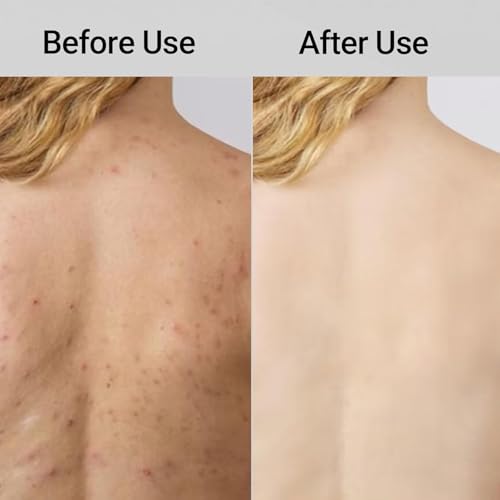 ZIVWAGX Blissal Exfoliating Shower Towel, 2-in-1 Exfoliating Towel, Premium Scrub Wash Cloth for Body Face, Blissal Exfoliating Towels-Body Scrubber with 2 Sides for All Skin Types (Black) (Black)