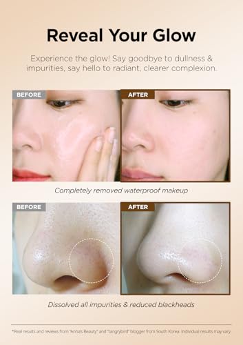 Hanskin BHA Pore Cleansing Balm – Korean Melting Balm Cleanser, Gentle Makeup Remover for Oily & Combination Skin | Solid-to-Oil Cleanser with BHA & Nourishing Oils | K-Beauty | 2.82 oz