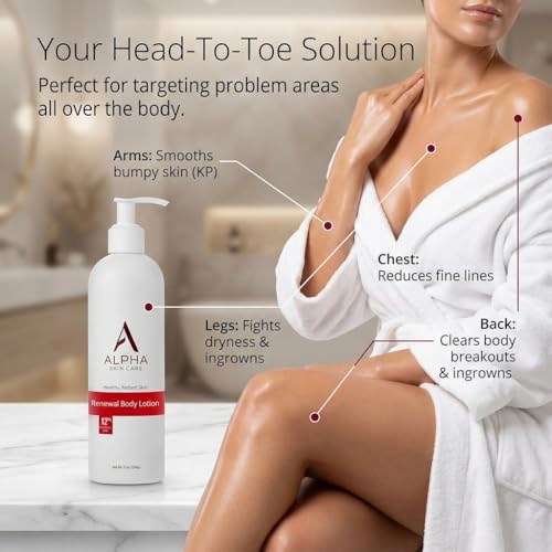 Alpha Skin Care Revitalizing Body Lotion, 12% Glycolic AHA, Simple & Effective Daily Moisturizer with Alpha Hydroxy Acid, Hydrates & Exfoliates for Soft, Smooth Skin, Anti-Aging, 12 Oz