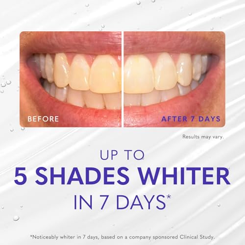 Smileactives Teeth Whitening Kit, Complete at Home Teeth Whitening Treatment, Travel Size Tooth Whitening, Stain Remover for White Teeth, Contains Clinical-Grade Hydrogen Peroxide, 30 Day Kit